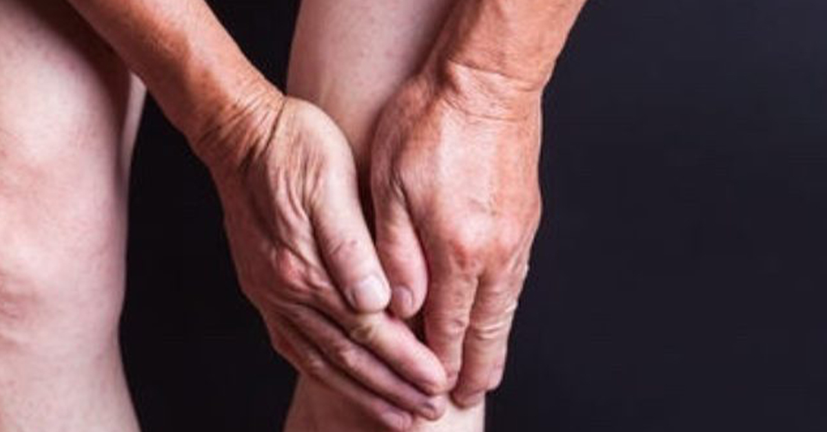 Five Facts You Should Know About Arthritis