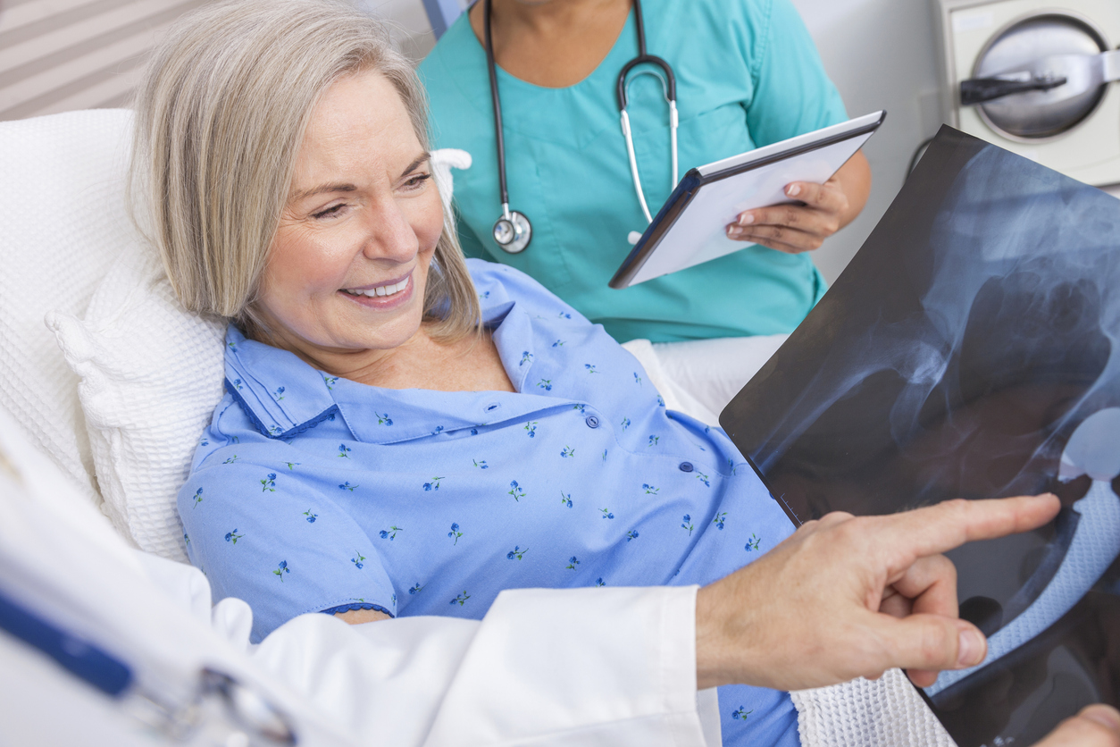 A lovely, middle-aged woman smiles at an X-ray while a doctor points at her hip replacement